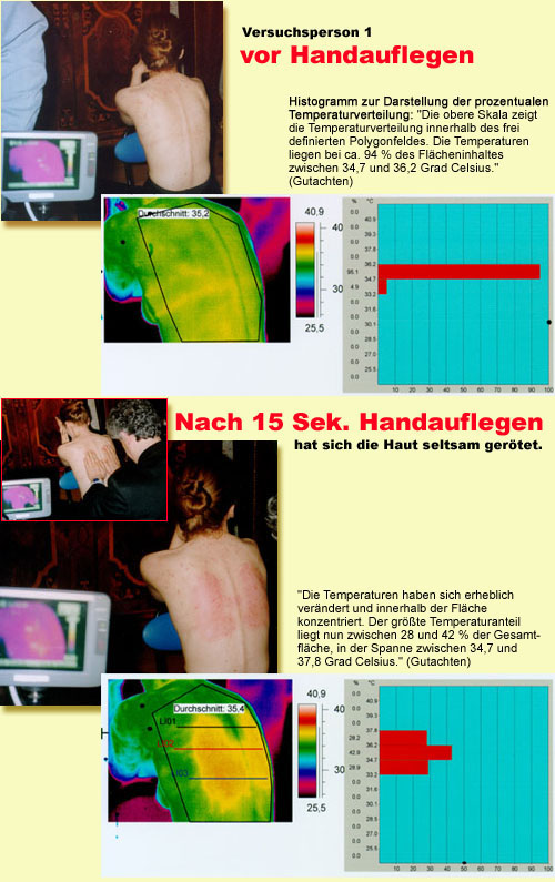 Thermografie einer Geistheilung - beim Handauflegen