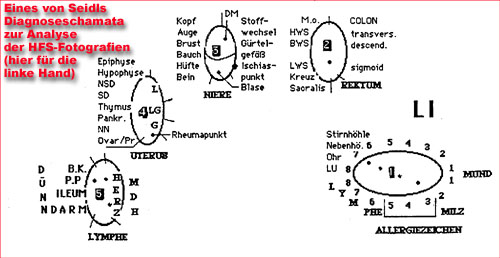 Seidls Diagnoseschema bei Geistheilung im Test